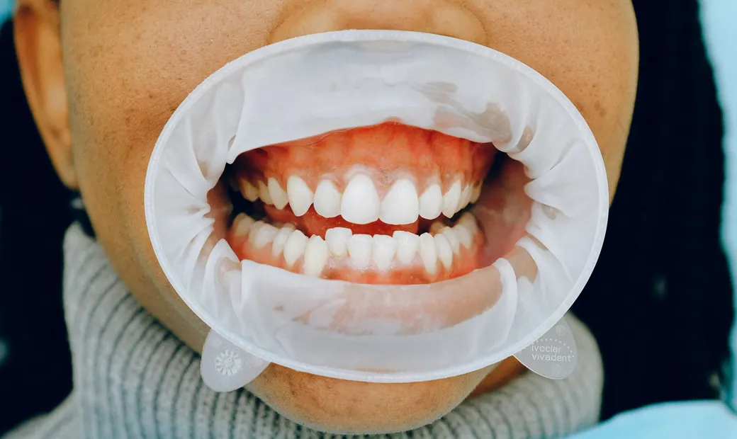 Oral Health illustration