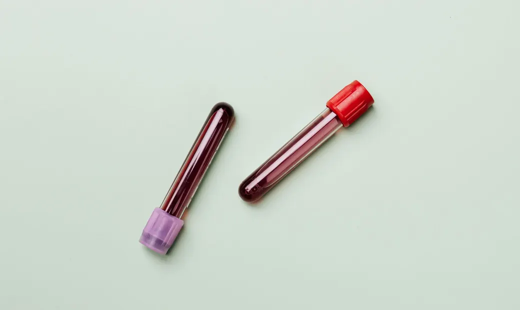 Blood Sugar illustration