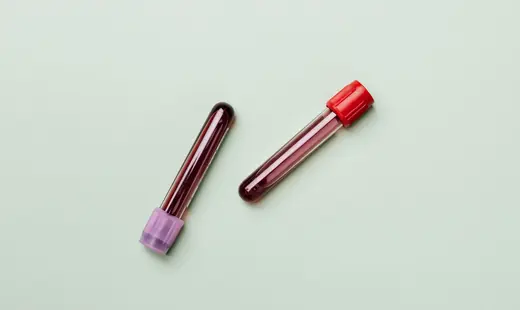 Blood Sugar illustration