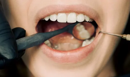 Oral Health illustration